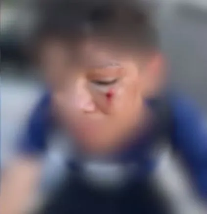 — Foto: Reprodução/Arquivo pessoal de Hemily Guimarães