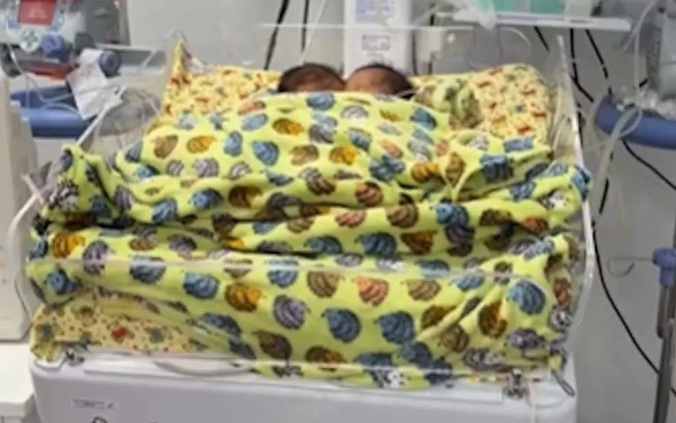 Bernardo e Eduardo estavam internados em Goiânia e se preparavam para uma cirurgia de alta complexidade que buscava separar os irmãos. Foto: Reprodução/Zacharias Cali